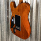 ESP LTD TE-1000 Evertune Koa Guitar & Bag LTE1000ETKNAT #1938 Used